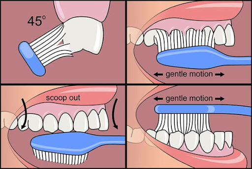 Brushing and Flossing Techniques. Dentist in Lewisville, NC. Dr. Joel Manchego, DDS, Manchego Dental